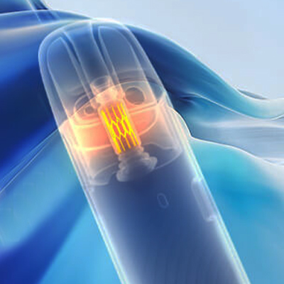 Žhavící hlava - Joyetech Evio Gleam - elektronická cigareta